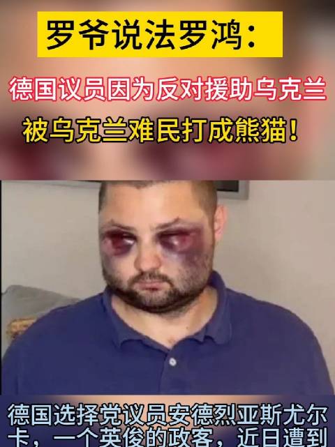 德國議員因爲反對援助烏克蘭，被烏難民打成熊貓！