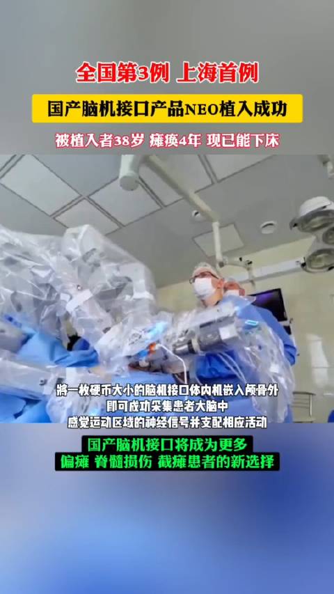 上海首例國產腦機接口，振奮人心！